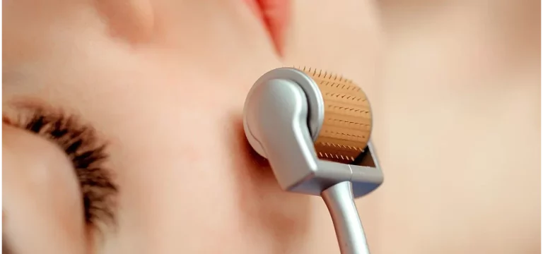 Derma roller or pen treatment