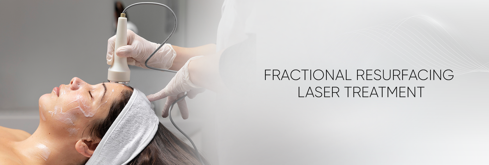 Laser Fine Line Treatment