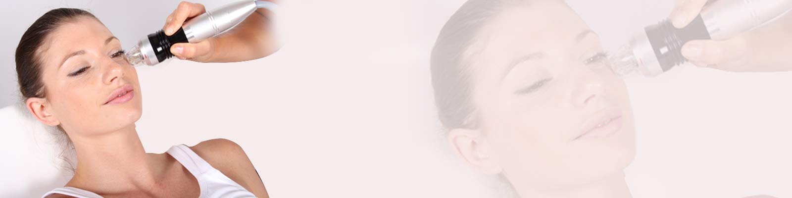 Scar Reduction with MNRF